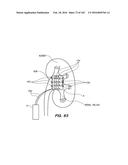 SYSTEM AND METHOD FOR OPTOGENETIC THERAPY diagram and image