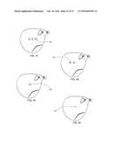 STABILIZING INSERT FOR A GOLF CLUB HEAD diagram and image