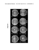 Endophytes and related methods diagram and image