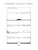 Common and Rare Genetic Variations Associated with Common Variable     Immunodeficiency (CVID) and Methods of Use Thereof for the Treatment and     Diagnosis of the Same diagram and image