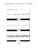 Common and Rare Genetic Variations Associated with Common Variable     Immunodeficiency (CVID) and Methods of Use Thereof for the Treatment and     Diagnosis of the Same diagram and image