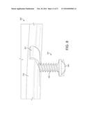 PORTABILITY ENHANCING HARDWARE FOR A PORTABLE ULTRASOUND SYSTEM diagram and image