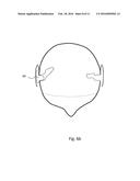 HEARING AID WITH AN ANTENNA diagram and image