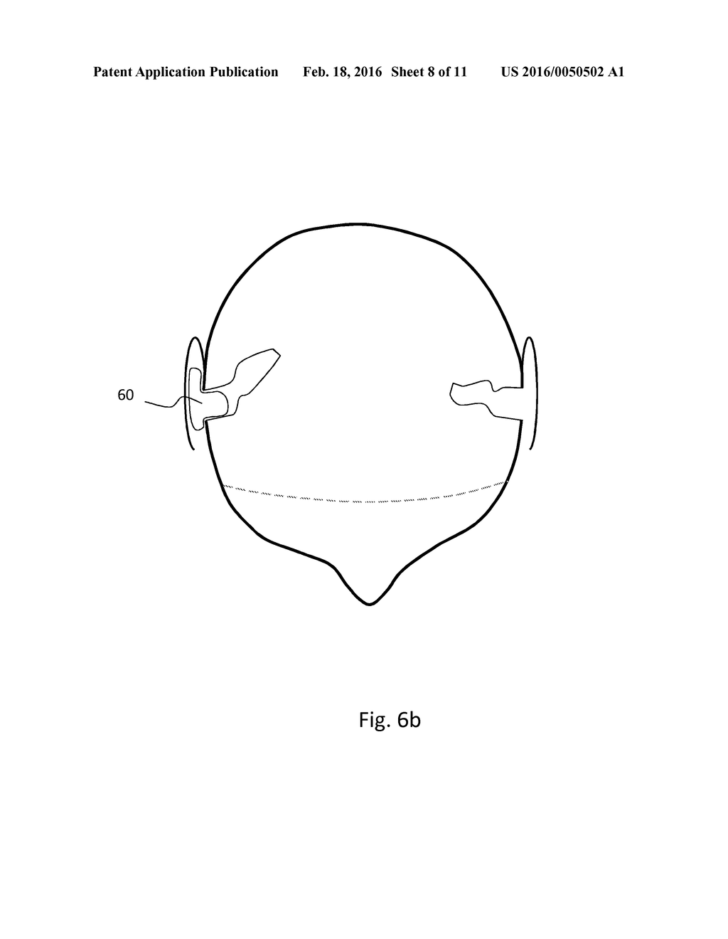HEARING AID WITH AN ANTENNA - diagram, schematic, and image 09