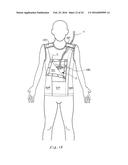 MEDICAL GARMENT diagram and image