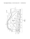 ENDOLUMINAL SYSTEM FOR GASTROINTESTINAL TREATMENT diagram and image