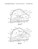 ENDOLUMINAL SYSTEM FOR GASTROINTESTINAL TREATMENT diagram and image