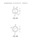 4-WAY CYSTOSCOPY CATHETER diagram and image