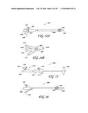 4-WAY CYSTOSCOPY CATHETER diagram and image