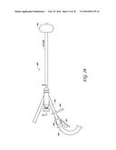 4-WAY CYSTOSCOPY CATHETER diagram and image