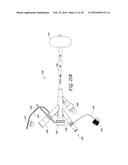 4-WAY CYSTOSCOPY CATHETER diagram and image