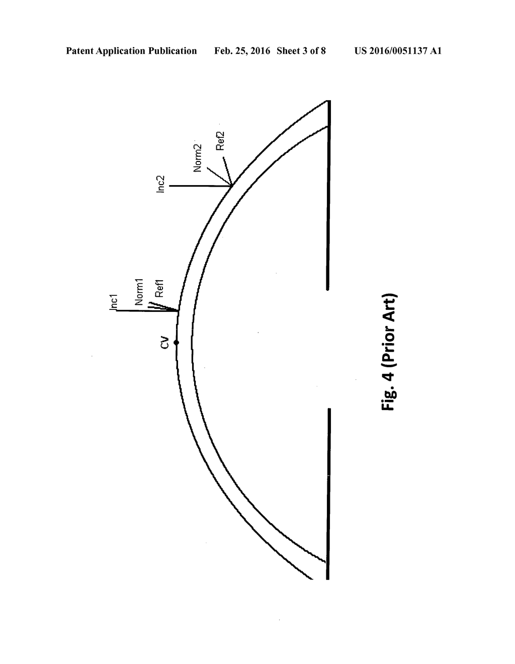 OPTICAL COHERENCE TOMOGRAPHY METHOD AND SYSTEM - diagram, schematic, and image 04