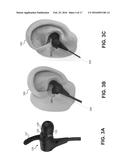 SYSTEM AND METHOD FOR PROVIDING SLEEP RECOMMENDATIONS USING EARBUDS WITH     BIOMETRIC SENSORS diagram and image