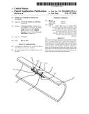 SURGICAL CLOSURE SYSTEMS AND METHODS diagram and image