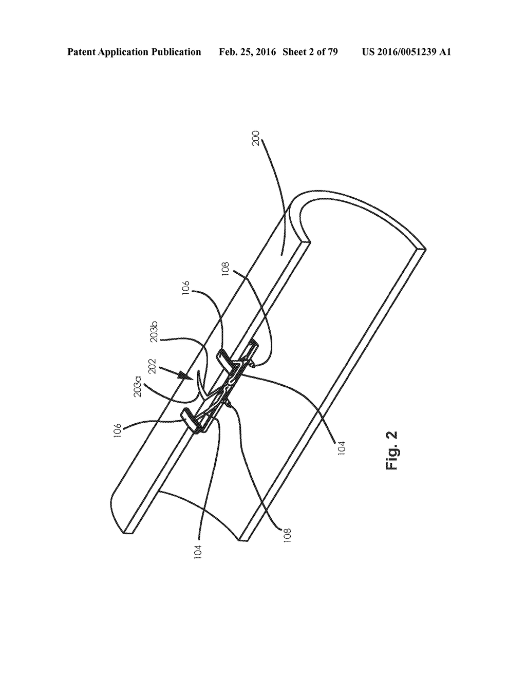 SURGICAL CLOSURE SYSTEMS AND METHODS - diagram, schematic, and image 03