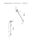 SURGICAL CLOSURE SYSTEMS AND METHODS diagram and image