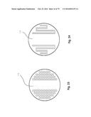 SURGICAL CLOSURE SYSTEMS AND METHODS diagram and image