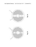 SURGICAL CLOSURE SYSTEMS AND METHODS diagram and image