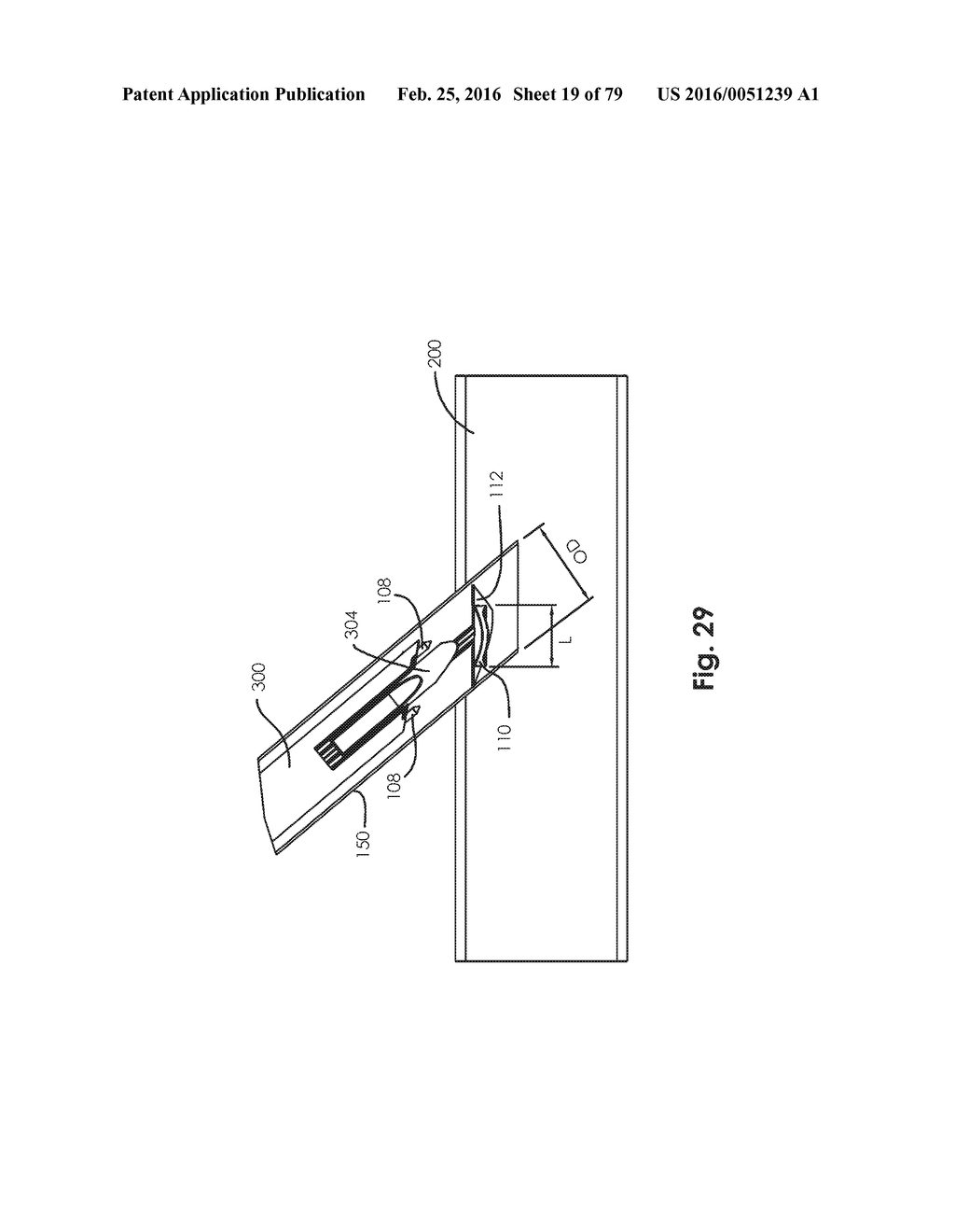 SURGICAL CLOSURE SYSTEMS AND METHODS - diagram, schematic, and image 20