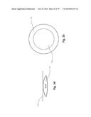 SURGICAL CLOSURE SYSTEMS AND METHODS diagram and image