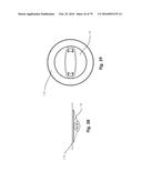 SURGICAL CLOSURE SYSTEMS AND METHODS diagram and image