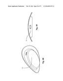 SURGICAL CLOSURE SYSTEMS AND METHODS diagram and image