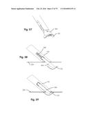 SURGICAL CLOSURE SYSTEMS AND METHODS diagram and image