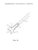 SURGICAL CLOSURE SYSTEMS AND METHODS diagram and image