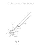 SURGICAL CLOSURE SYSTEMS AND METHODS diagram and image