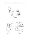 SURGICAL CLOSURE SYSTEMS AND METHODS diagram and image