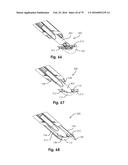 SURGICAL CLOSURE SYSTEMS AND METHODS diagram and image