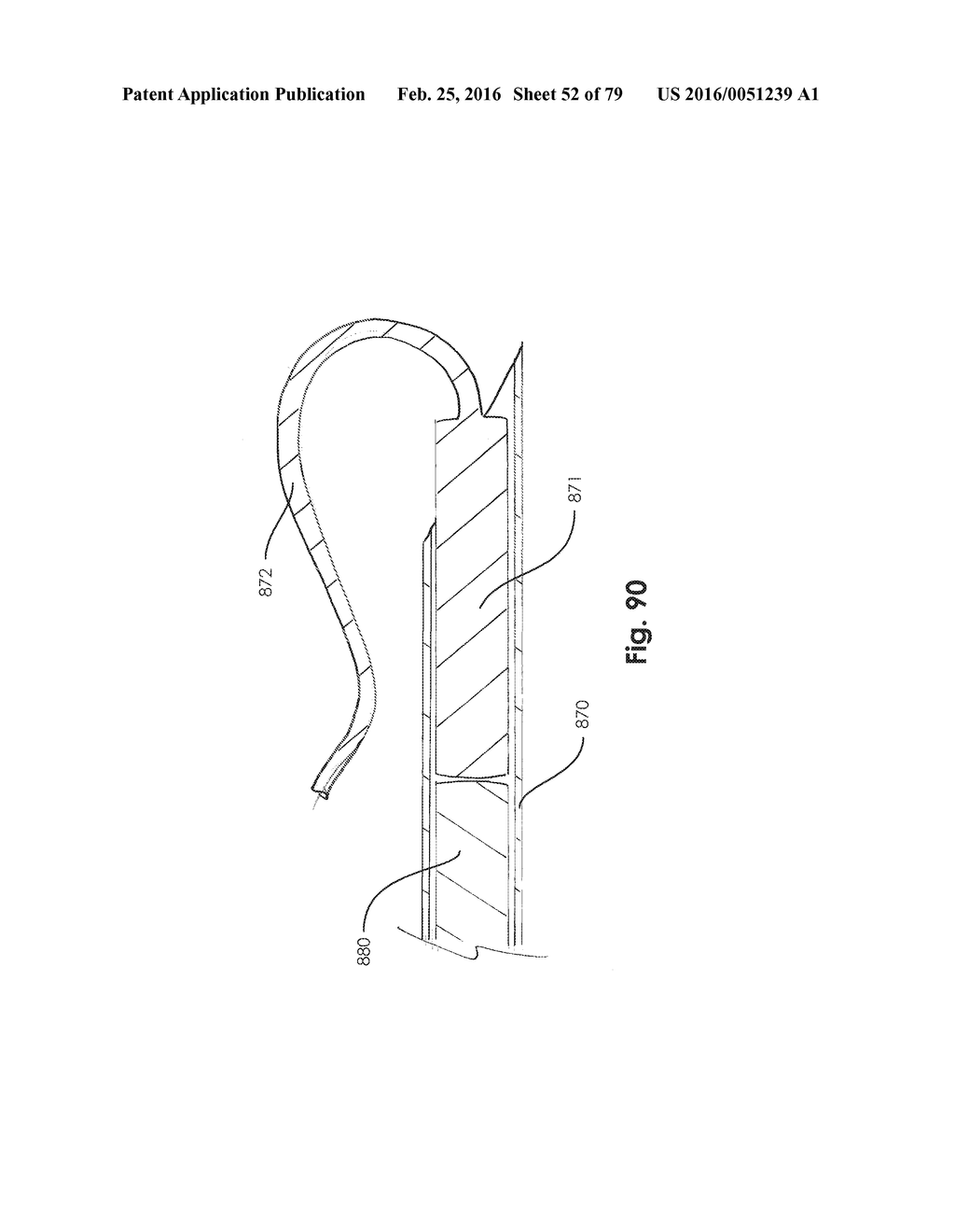 SURGICAL CLOSURE SYSTEMS AND METHODS - diagram, schematic, and image 53