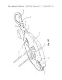 SURGICAL CLOSURE SYSTEMS AND METHODS diagram and image