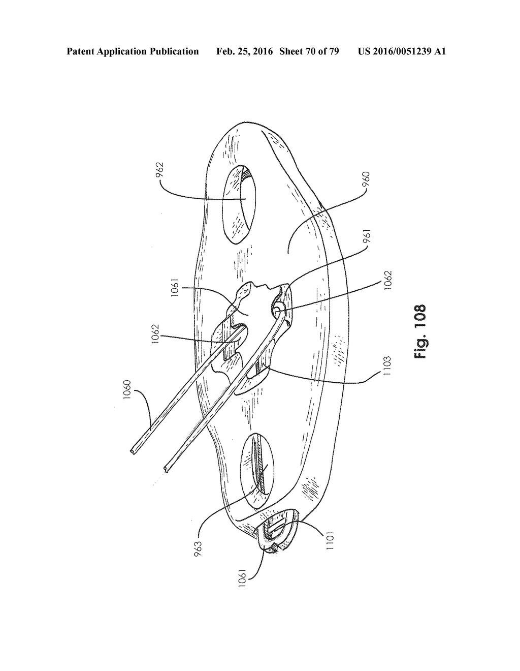 SURGICAL CLOSURE SYSTEMS AND METHODS - diagram, schematic, and image 71