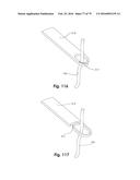 SURGICAL CLOSURE SYSTEMS AND METHODS diagram and image