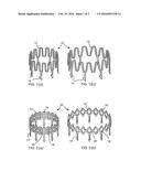 BLOOD VESSEL CLOSURE CLIP AND DELIVERY DEVICE diagram and image