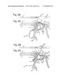 ERGONOMIC LOCKING MECHANISM diagram and image