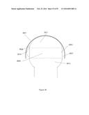 COMPOSITE MATERIAL SPINAL IMPLANT diagram and image