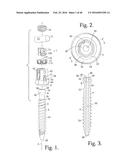 POLYAXIAL BONE ANCHOR WITH POP-ON SHANK AND FRICTION FIT RETAINER WITH LOW     PROFILE EDGE LOCK diagram and image