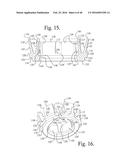 POLYAXIAL BONE ANCHOR WITH POP-ON SHANK AND FRICTION FIT RETAINER WITH LOW     PROFILE EDGE LOCK diagram and image