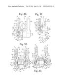 POLYAXIAL BONE ANCHOR WITH POP-ON SHANK AND FRICTION FIT RETAINER WITH LOW     PROFILE EDGE LOCK diagram and image