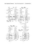 POLYAXIAL BONE ANCHOR WITH POP-ON SHANK AND FRICTION FIT RETAINER WITH LOW     PROFILE EDGE LOCK diagram and image