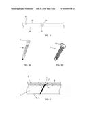 BONE PLATE AND METHOD OF USE diagram and image