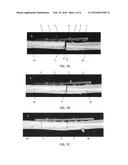 BONE PLATE AND METHOD OF USE diagram and image