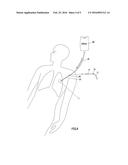 LIVING BODY HEATING INSTRUMENT AND CONTROL DEVICE diagram and image