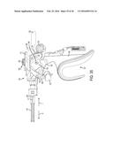 ELECTROSURGICAL ELECTRODE MECHANISM diagram and image