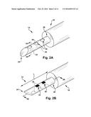 APPARATUS AND METHOD FOR TREATING A NEUROMUSCULAR DEFECT diagram and image