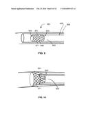 DEVICE AND METHODS FOR CROSSING OCCLUSIONS diagram and image