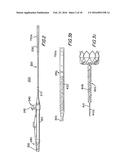 ATRIAL APPENDAGE BLOOD FILTRATION SYSTEMS diagram and image