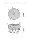 ATRIAL APPENDAGE BLOOD FILTRATION SYSTEMS diagram and image